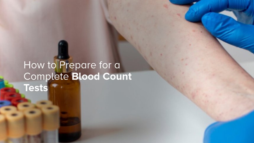 Dengue Tests: Types, Accuracy, and When to Get Tested